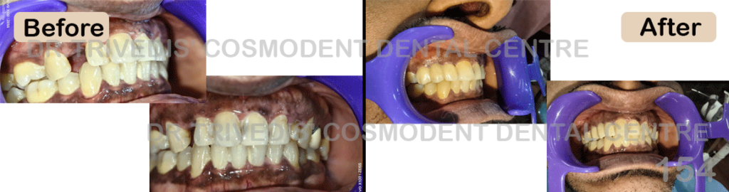 CASE 154
