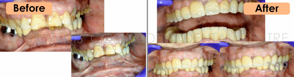CASE 159