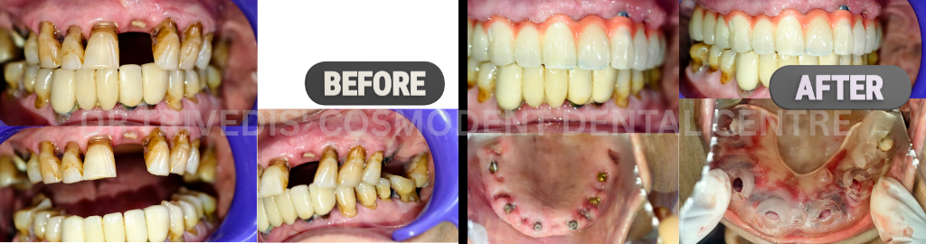 CASE 180